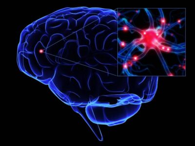 Neurorrehabilitación o neurorehabilitación ¿Cómo se escribe?, imagen cerebro